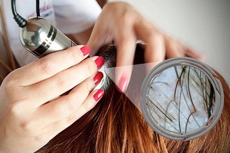 Tricologia - Diagnóstico e Tratamento Capilar no Leblon - Rio de Janeiro - RJ